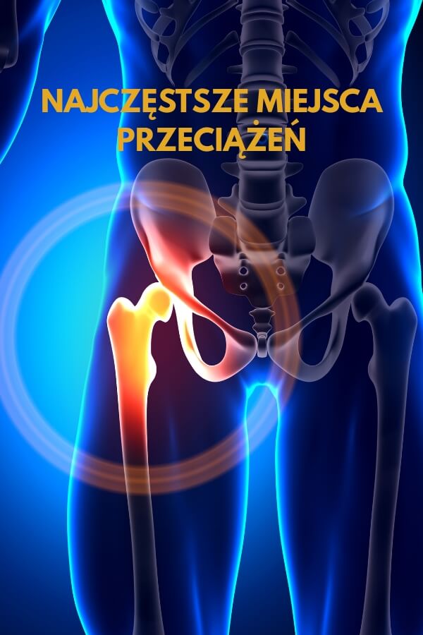 ból biodra po bieganiu pokazany na grafice